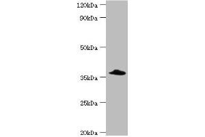 Western blot All lanes: Complement factor H-related protein 3 antibody at 6 μg/mL + Rat heart tissue Secondary Goat polyclonal to rabbit IgG at 1/10000 dilution Predicted band size: 38, 31 kDa Observed band size: 38 kDa (CFHR3 antibody  (AA 80-200))