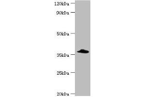 Western blot All lanes: Complement factor H-related protein 3 antibody at 6 μg/mL + Rat heart tissue Secondary Goat polyclonal to rabbit IgG at 1/10000 dilution Predicted band size: 38, 31 kDa Observed band size: 38 kDa (CFHR3 antibody  (AA 80-200))