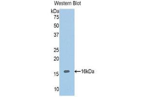Western Blotting (WB) image for anti-ADAM Metallopeptidase with Thrombospondin Type 1 Motif, 1 (ADAMTS1) (AA 854-967) antibody (ABIN1857898) (ADAMTS1 antibody  (AA 854-967))