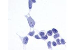 Anti-Frizzled-6 antibody immunocytochemistry (ICC) staining of untransfected HEK293 human embryonic kidney cells. (FZD6 antibody  (N-Term))