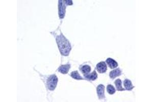 Anti-Frizzled-6 antibody immunocytochemistry (ICC) staining of untransfected HEK293 human embryonic kidney cells.