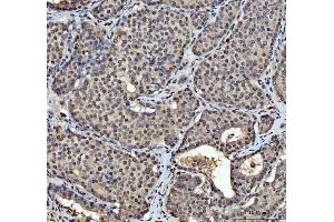 IHC analysis of hnRNP L/HNRNPL using anti-hnRNP L/HNRNPL antibody (ABIN7600130). (HNRNPL antibody  (AA 152-569))