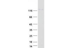 NFATC3 Protein (Transcript Variant 1) (Myc-DYKDDDDK Tag)
