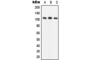 Western blot analysis of GLUR1 (pS849) expression in Jurkat (A), mouse kidney (B), rat liver (C) whole cell lysates.