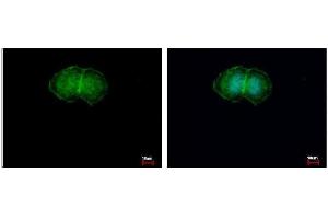 ICC/IF Image L-Plastin antibody detects LCP1 protein at membrane by immunofluorescent analysis. (LCP1 antibody)