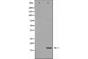 Western blot analysis of 293T whole cell lysates, using NPC2 Antibody. (NPC2 antibody  (N-Term))