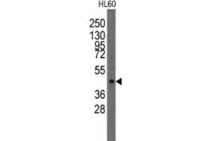 Western Blotting (WB) image for anti-LIM Homeobox Transcription Factor 1, alpha (LMX1A) antibody (ABIN2997858)
