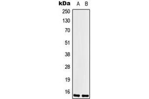 Western blot analysis of LSM1 expression in Hela (A), HEK293T (B) whole cell lysates. (LSM1 antibody  (Center))