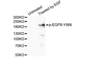 Western Blotting (WB) image for anti-Epidermal Growth Factor Receptor (EGFR) (pTyr998) antibody (ABIN1870110) (EGFR antibody  (pTyr998))