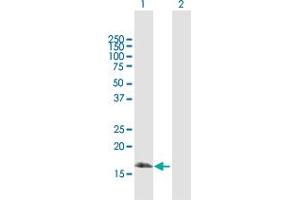 Western Blot analysis of BIRC5 expression in transfected 293T cell line by BIRC5 MaxPab polyclonal antibody. (Survivin antibody  (AA 1-142))