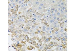 Immunohistochemistry of paraffin-embedded Rat liver using TROVE2 Polyclonal Antibody at dilution of 1:100 (40x lens). (TROVE2 antibody)
