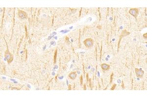 Detection of GRM1 in Human Cerebrum Tissue using Polyclonal Antibody to Glutamate Receptor, Metabotropic 1 (GRM1) (Metabotropic Glutamate Receptor 1 antibody  (AA 165-592))