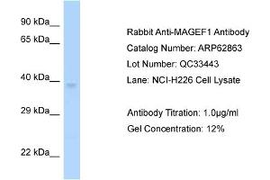 Western Blotting (WB) image for anti-Melanoma Antigen Family F, 1 (MAGEF1) (C-Term) antibody (ABIN2789272)
