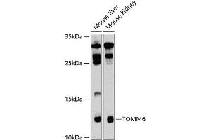 anti-Translocase of Outer Mitochondrial Membrane 6 Homolog (TOMM6) (AA 1-74) antibody