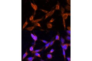 Immunofluorescence analysis of NIH-3T3 cells using VMP1 Polyclonal Antibody (ABIN7271283) at dilution of 1:100 (40x lens). (VMP1 antibody  (C-Term))