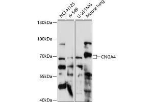 CNGA4 抗体  (AA 416-575)