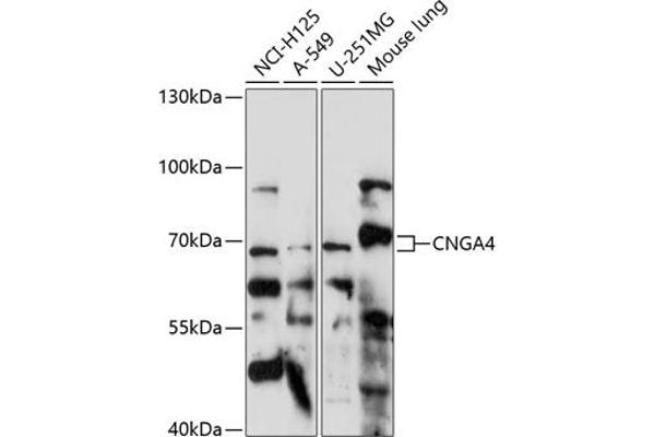CNGA4 anticorps  (AA 416-575)