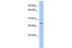 FAM78A antibody used at 1 ug/ml to detect target protein. (FAM78A antibody  (N-Term))