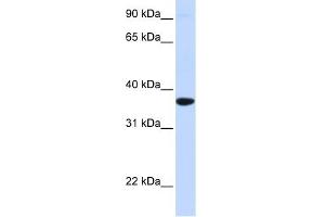 SCGN antibody used at 1 ug/ml to detect target protein. (SCGN antibody  (Middle Region))