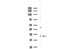 anti-Androgen-Induced 1 (AIG1) (C-Term) antibody