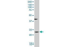 BLVRB polyclonal antibody (A01), Lot # 060104JC01 Western Blot analysis of BLVRB expression in K-562 . (BLVRB antibody  (AA 107-206))