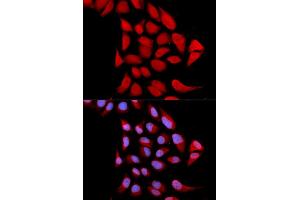 Immunofluorescence analysis of U2OS cells using PSMA6 antibody. (PSMA6 antibody)