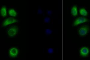 Detection of IL31RA in Human MCF7 cell using Polyclonal Antibody to Interleukin 31 Receptor A (IL31RA) (IL31RA antibody  (AA 205-456))