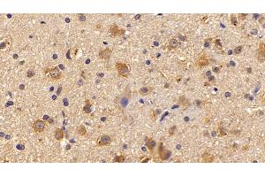 Detection of PNMA2 in Rat Cerebrum Tissue using Polyclonal Antibody to Paraneoplastic Antigen MA2 (PNMA2) (PNMA2 antibody  (AA 74-333))