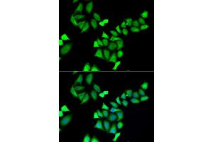 Immunofluorescence analysis of A549 cells using GALE antibody.