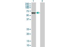 Western Blot analysis of TOE1 expression in transfected 293T cell line by TOE1 monoclonal antibody (M03A), clone 1D4. (TOE1 antibody  (AA 1-510))