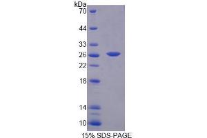 SDS-PAGE analysis of Mouse BCAT1 Protein.