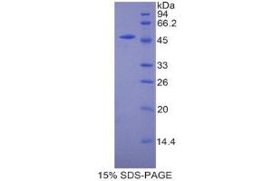 SDS-PAGE (SDS) image for Carnitine Palmitoyltransferase 1A (Liver) (CPT1A) (AA 568-773) protein (His tag,GST tag) (ABIN1877326)