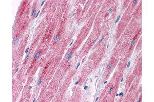 Immunohistochemistry (IHC) image for anti-Pyruvate Dehydrogenase Kinase, Isozyme 2 (PDK2) (Middle Region) antibody (ABIN2777433) (PDK2 antibody  (Middle Region))