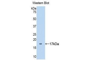 Western Blotting (WB) image for anti-Serpin Peptidase Inhibitor, Clade G (C1 Inhibitor), Member 1 (SERPING1) (AA 399-500) antibody (ABIN3201845) (SERPING1 antibody  (AA 399-500))