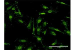 Immunofluorescence of monoclonal antibody to RNF40 on HeLa cell. (RNF40 antibody  (AA 102-200))