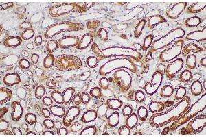 Immunohistochemistry (Paraffin-embedded Sections) (IHC (p)) image for anti-Plasminogen Activator Inhibitor 2 (SERPINB2) antibody (ABIN7234543)