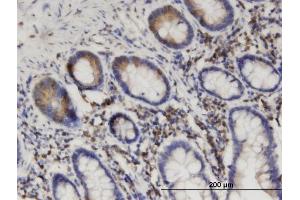 Immunoperoxidase of monoclonal antibody to SEPT8 on formalin-fixed paraffin-embedded human small Intestine. (Septin 8 antibody  (AA 1-258))