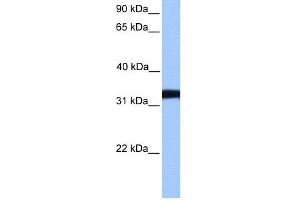 WB Suggested Anti-LDHC Antibody Titration: 0. (Lactate Dehydrogenase C antibody  (Middle Region))