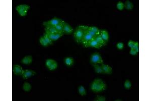 Immunofluorescence staining of HepG2 cells with ABIN7173411 at 1:133, counter-stained with DAPI. (DAK antibody  (AA 396-561))