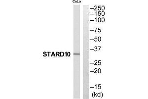 Western Blotting (WB) image for anti-StAR-Related Lipid Transfer (START) Domain Containing 10 (STARD10) (N-Term) antibody (ABIN1852528) (STARD10 antibody  (N-Term))