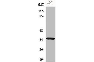 Western Blot analysis of HeLa cells using ELOVL4 Polyclonal Antibody