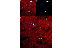 Expression of neuropeptide Y5 receptor in rat striatum - Immunohistochemical staining of rat striatum using Anti-NPY5R Antibody (ABIN7043375 and ABIN7044673). (NPY5R antibody  (3rd Intracellular Loop))