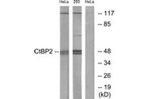 Western blot analysis of extracts from HeLa/293 cells, using CtBP2 Antibody. (CTBP2 antibody  (AA 396-445))