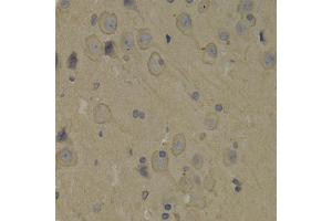 Immunohistochemistry of paraffin-embedded rat brain using PIK3R1 antibody. (PIK3R1 antibody)