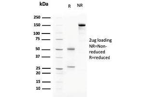 SDS-PAGE Analysis Purified C1QA Mouse Monoclonal Antibody (C1QA/2783). (C1QA antibody  (AA 104-237))