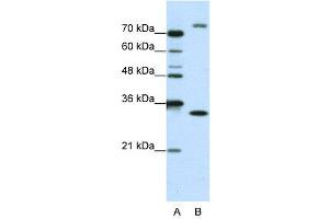 WB Suggested Anti-EXOSC2  Antibody Titration: 1. (EXOSC2 antibody  (N-Term))
