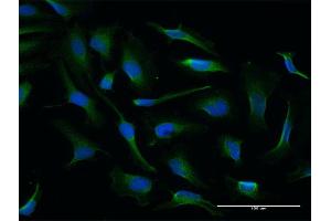 Immunofluorescence of purified MaxPab antibody to NQO2 on HeLa cell. (NQO2 antibody  (AA 1-231))