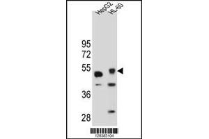 Western blot analysis in HepG2 and HL-60 cell line lysates (35ug/lane). (TIGD3 antibody  (C-Term))