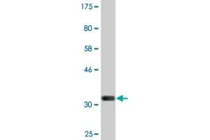 Western Blot detection against Immunogen (36. (GOLM1 antibody  (AA 302-401))