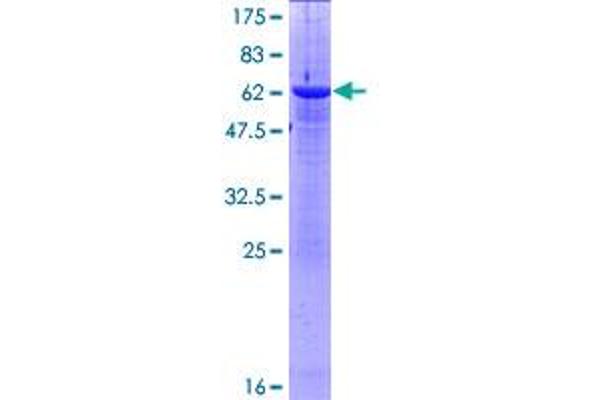 ASMT Protein (AA 1-298) (GST tag)
